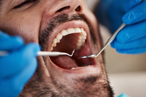 Tooth Infection Emergency Dentist in WA